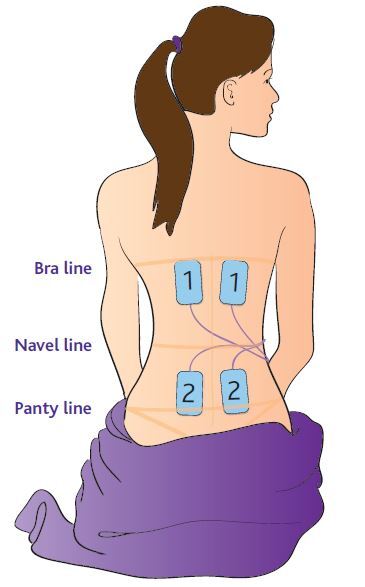 TENS machine pad placement